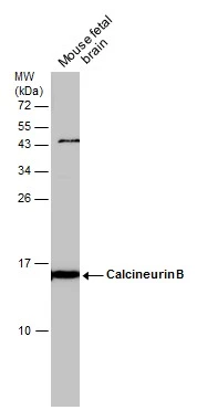 Calcineurin B antibody